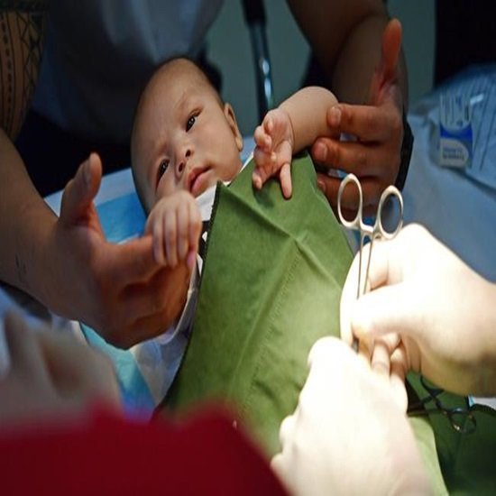 Circumcision in Children